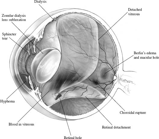 Figure 23–1