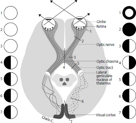 Figure 11–2