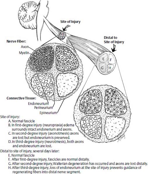 Figure 11–8