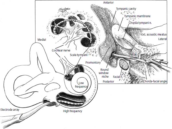 Fig. 31.1