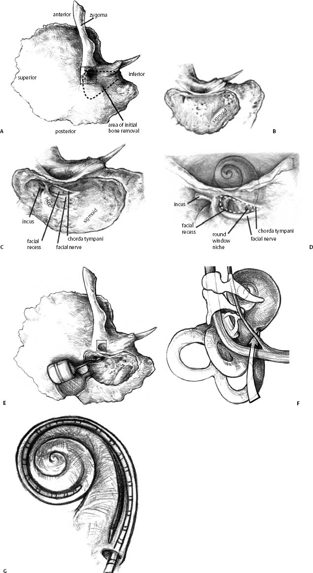 Fig. 31.6