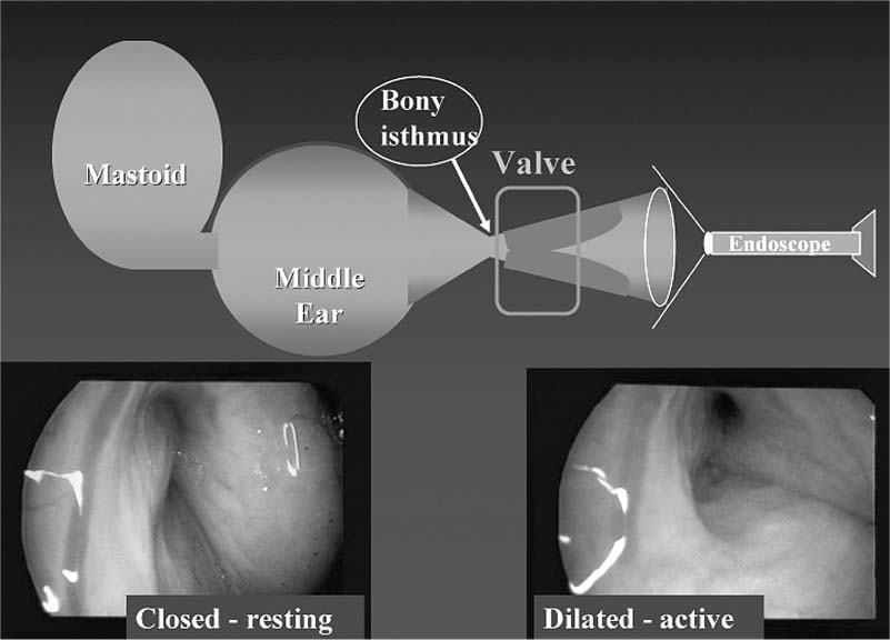 eustachian tube muscles