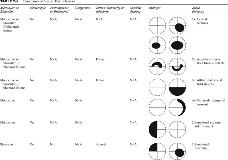 Visual Field Defects Diagram