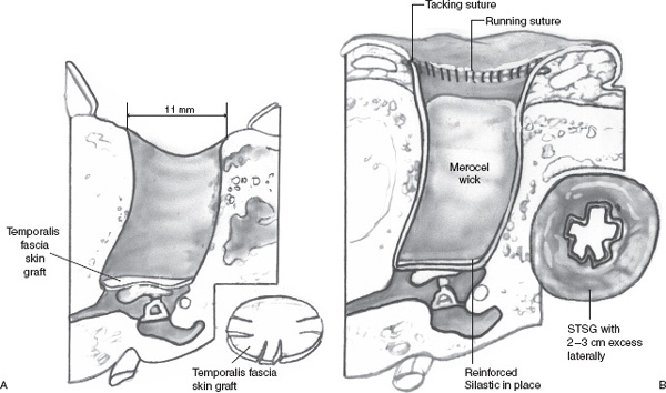 Correction Of Congenital Malformations | Ento Key