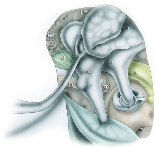 Combined Endoscopicmicroscopic Middle Ear Surgery For Cholesteatoma