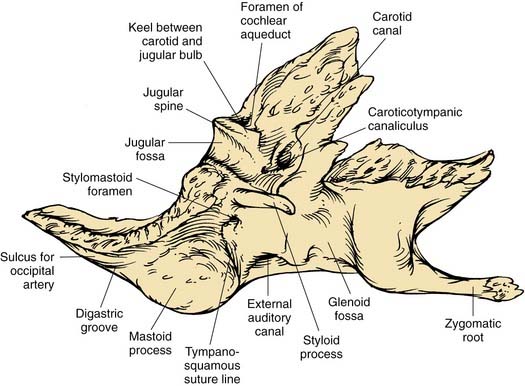Anatomy of the Temporal Bone, External Ear, and Middle Ear ...