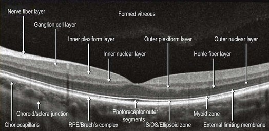 normal retina oct image