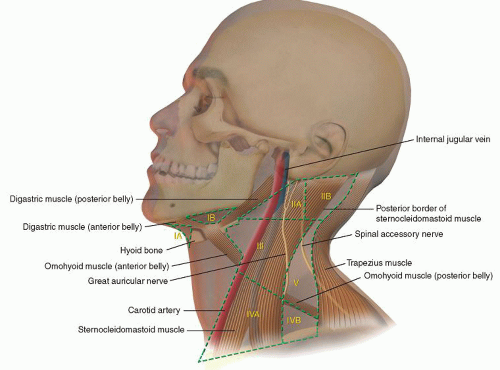 radical neck dissection