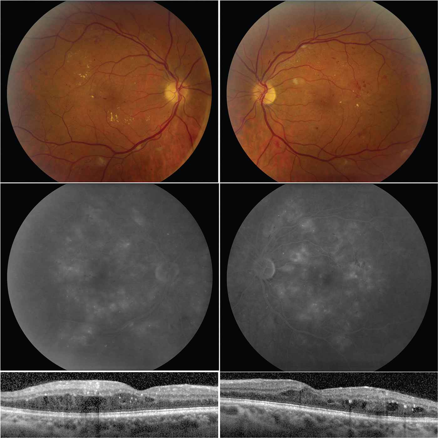 retina vitreous medical group