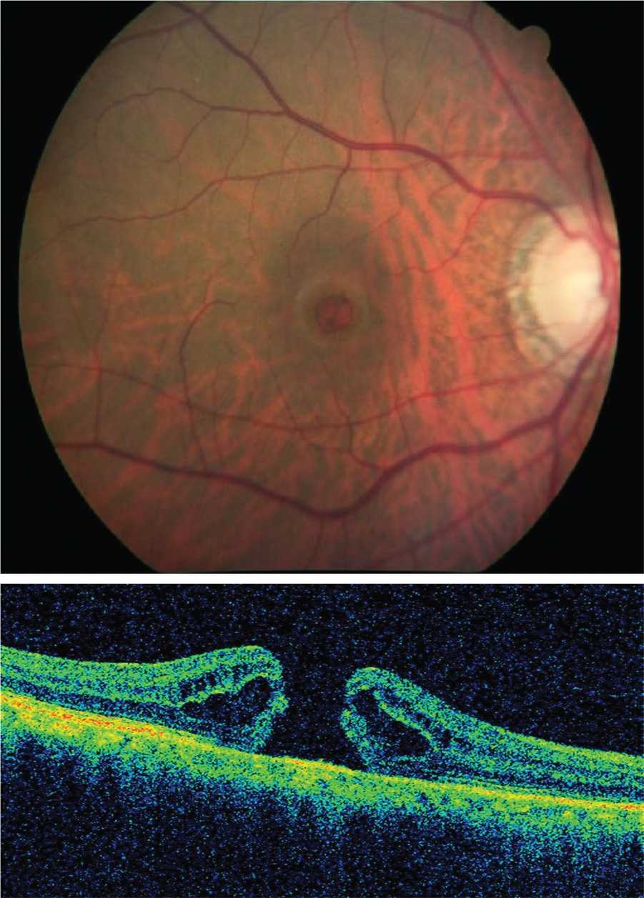 retina vitreous medical group