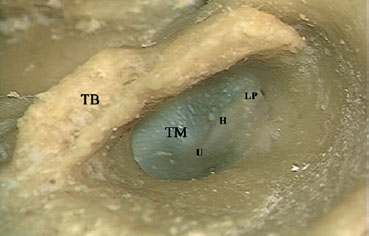 Fig. 2.12