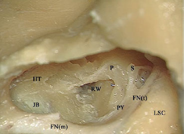 Fig. 2.25