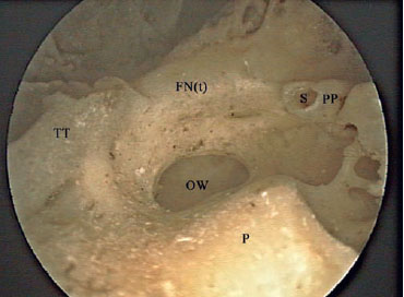 Fig. 2.29