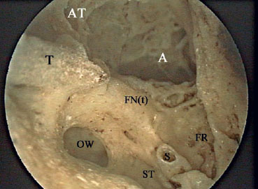 Fig. 2.35