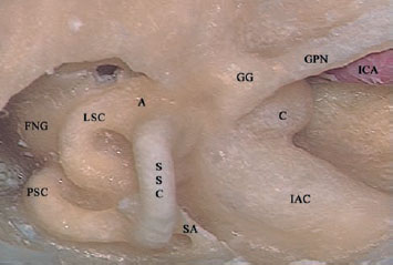 Fig. 2.44