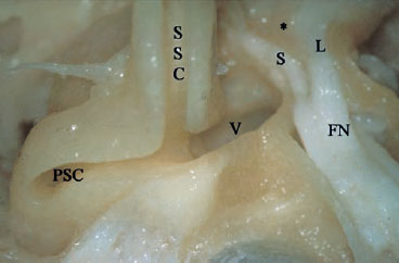 Fig. 2.45