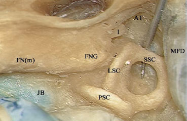 Fig. 2.46