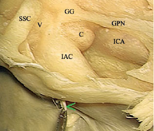 Fig. 2.54