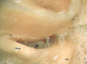 Fig. 3.11