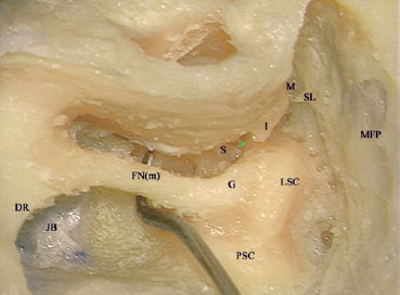 Fig. 3.17