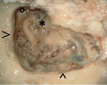 Fig. 3.37