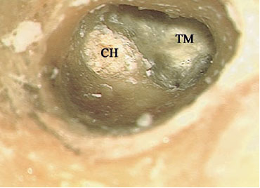 Fig. 3.38b