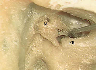 Fig. 3.49