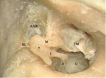 Fig. 3.50