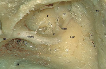 Fig. 3.60