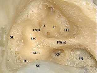 Fig. 3.61