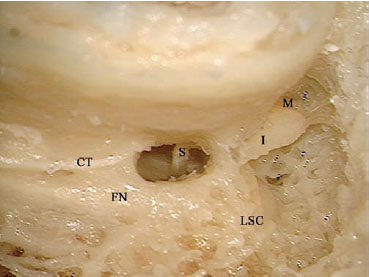 Fig. 3.65