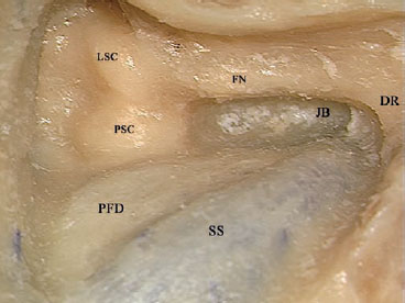 Fig. 3.76