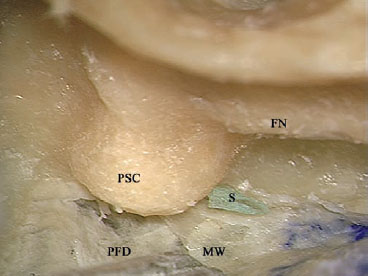 Fig. 3.83