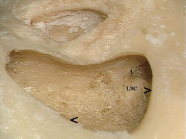 Fig. 3.93