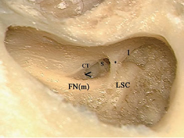 Fig. 3.95