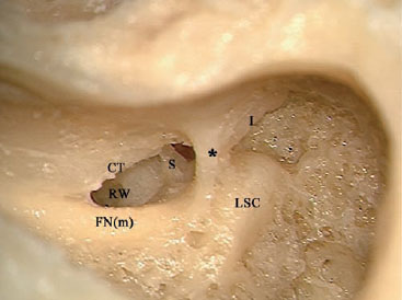 Fig. 3.96