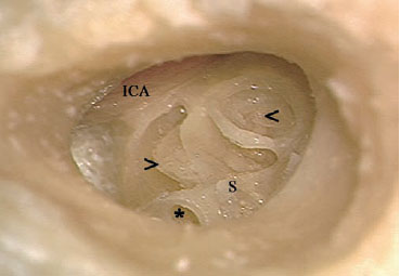 Fig. 3.112