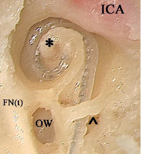 Fig. 3.121