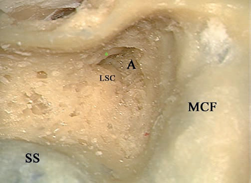 Fig. 4.5