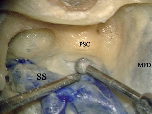 Fig. 4.14