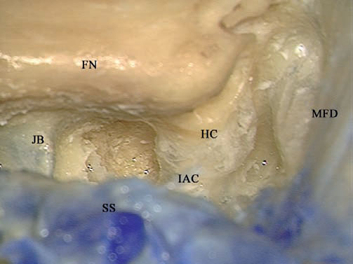 Fig. 4.32