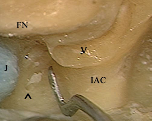 Fig. 4.48