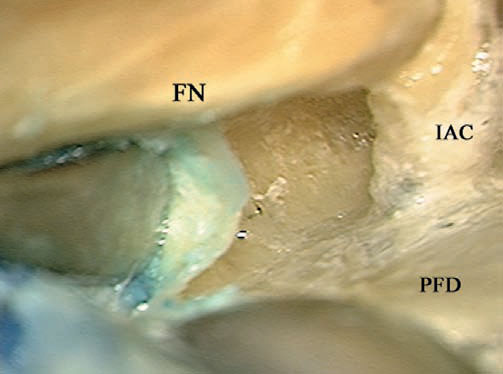 Fig. 4.51