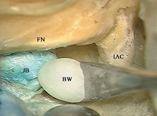 Fig. 4.52