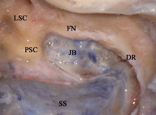 Fig. 4.57