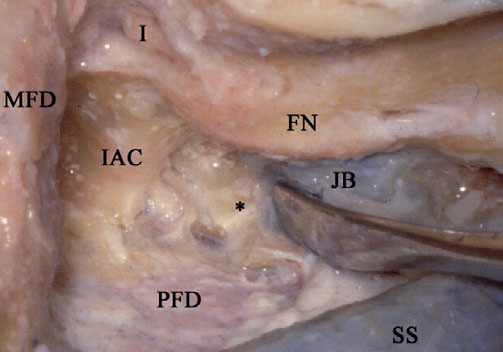 Fig. 4.60