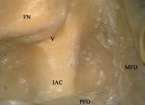 Fig. 4.64