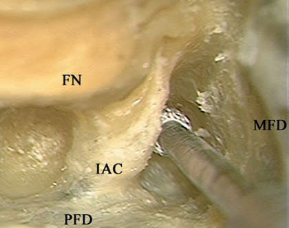 Fig. 4.66