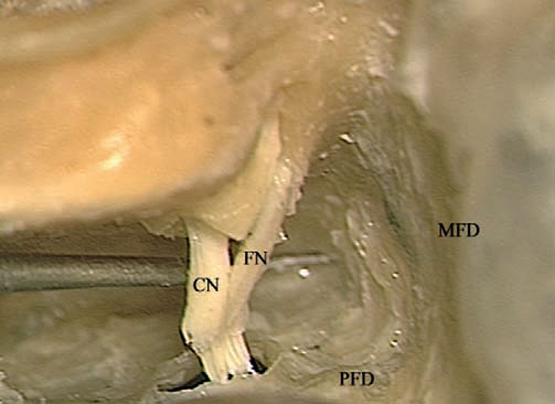 Fig. 4.70