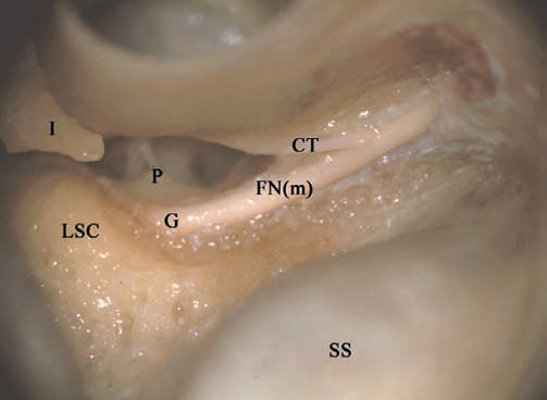 Fig. 4.74